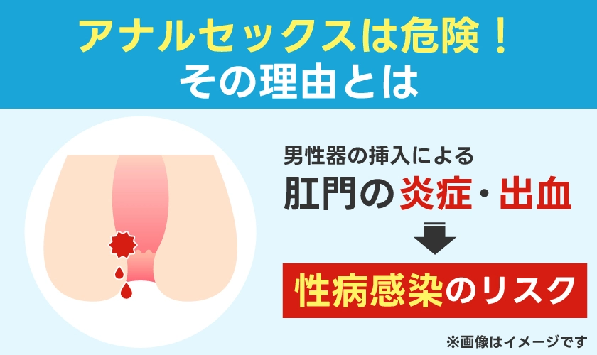 アナルセックスの危険性 【男女】