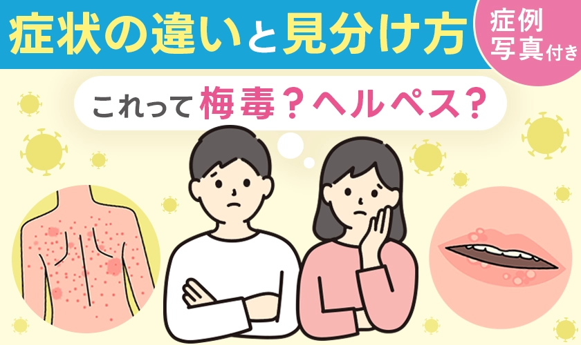 梅毒コラム