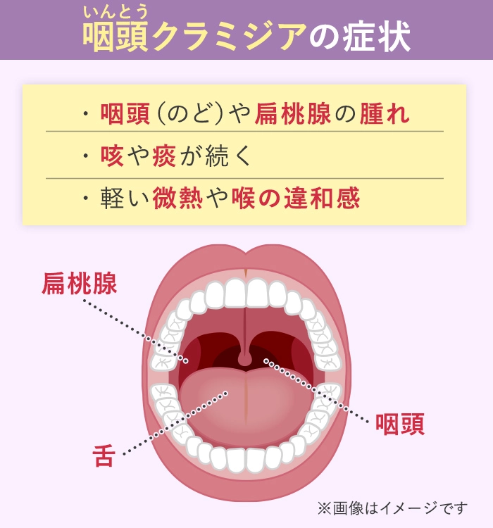 クラミジアは咽頭(喉)にも感染