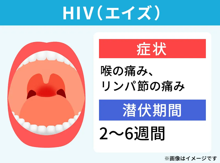 喉の痛みやリンパ節の腫れを引き起こすHIV