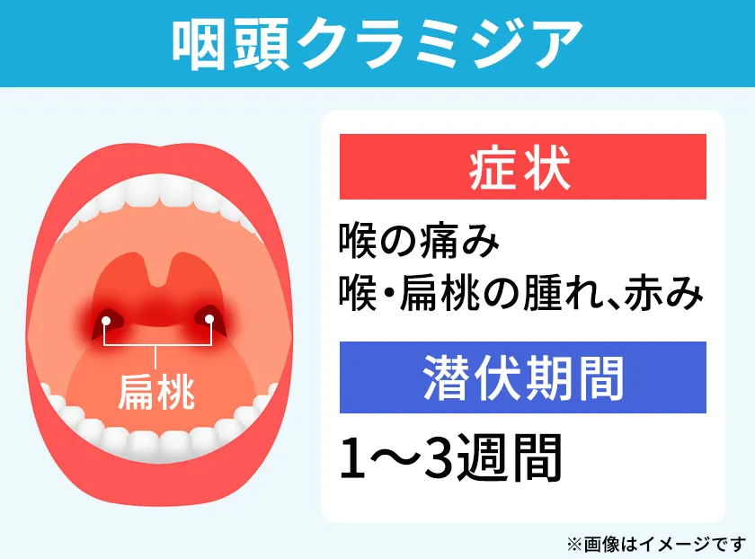 喉の痛みや腫れを引き起こす咽頭クラミジア