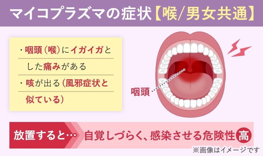 マイコプラズマ(性病)の喉に生じる男女共通の症状