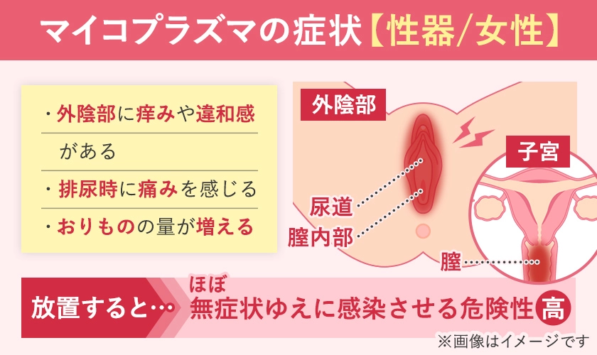 マイコプラズマ(性病)の女性の症状と発生部位