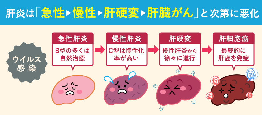 ウイルス性肝炎悪化の流れ