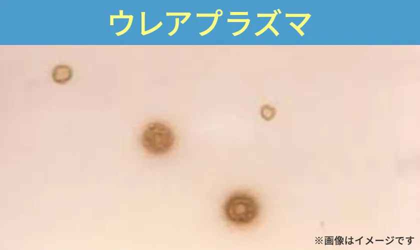 ウレアプラズマは陰部の炎症を引き起こす細菌です