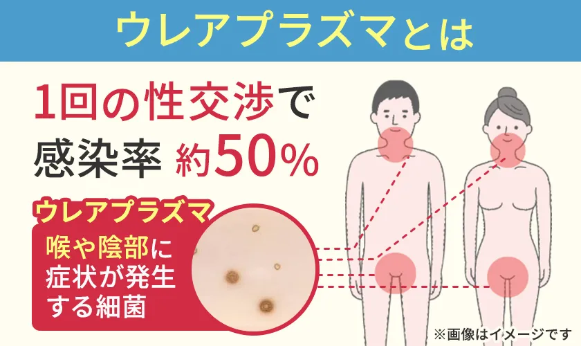 ウレアプラズマとは性行為で感染する性感染症です