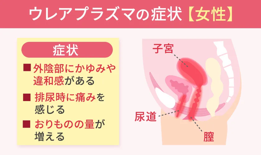 女性のウレアプラズマの症状と発生部位