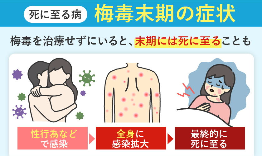 梅毒 末期