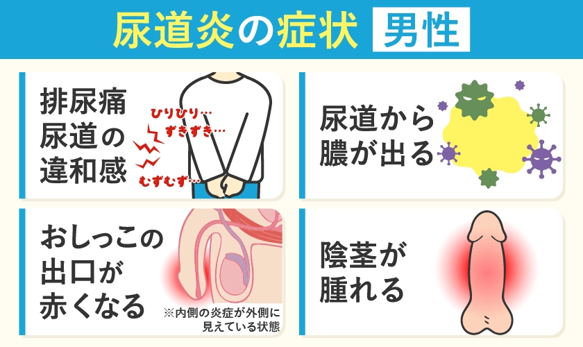男性の尿道炎の症状