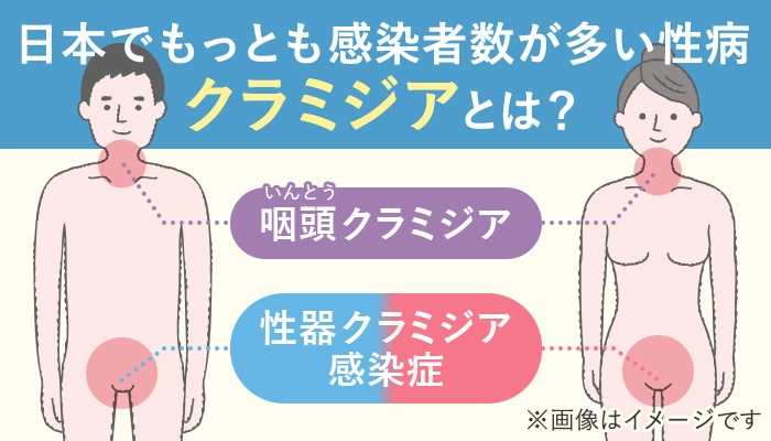 日本で最も多い性病クラミジアとは