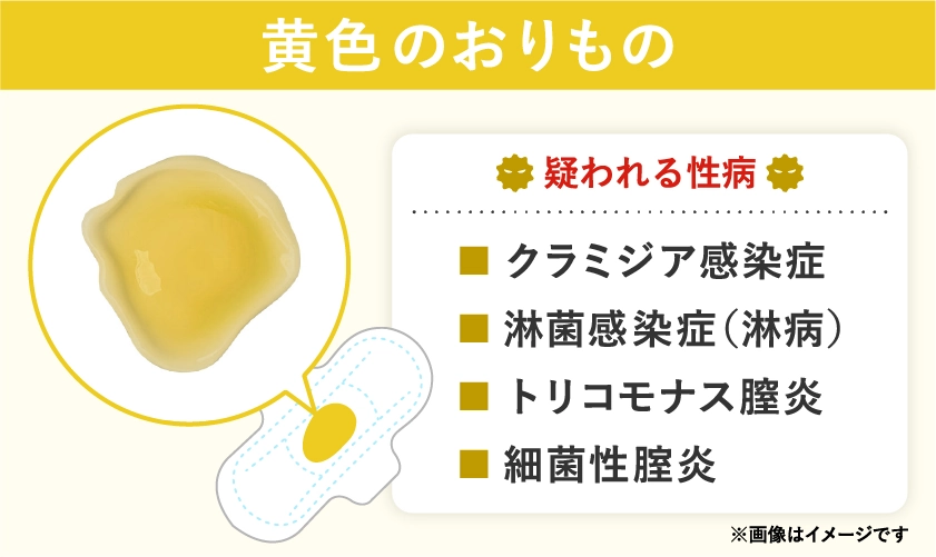 黄色いおりもので疑われる病気や性病