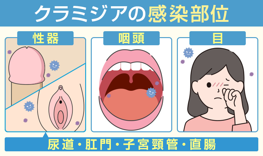 クラミジアの感染部位 性器・咽頭・目・尿道・肛門・子宮頚管・直腸
