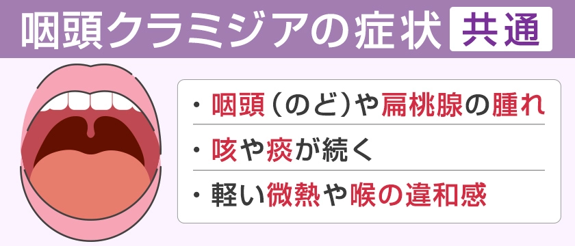 咽頭クラミジアの症状 男女共通 のどや扁桃腺の腫れ 咳や痰が続く